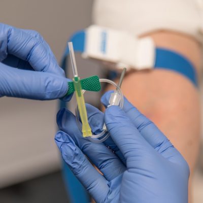 Prelievi del sangue a Roma: superare code e attese senza stress